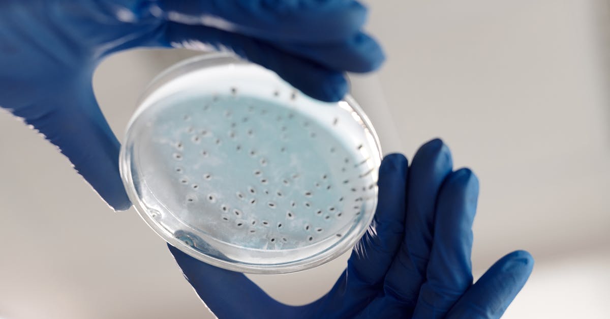 Are these bacteria colonies in my canned sardines? - Person Holding a Petri Dish Are these bacteria colonies in my canned sardines? - Person Holding a Petri Dish