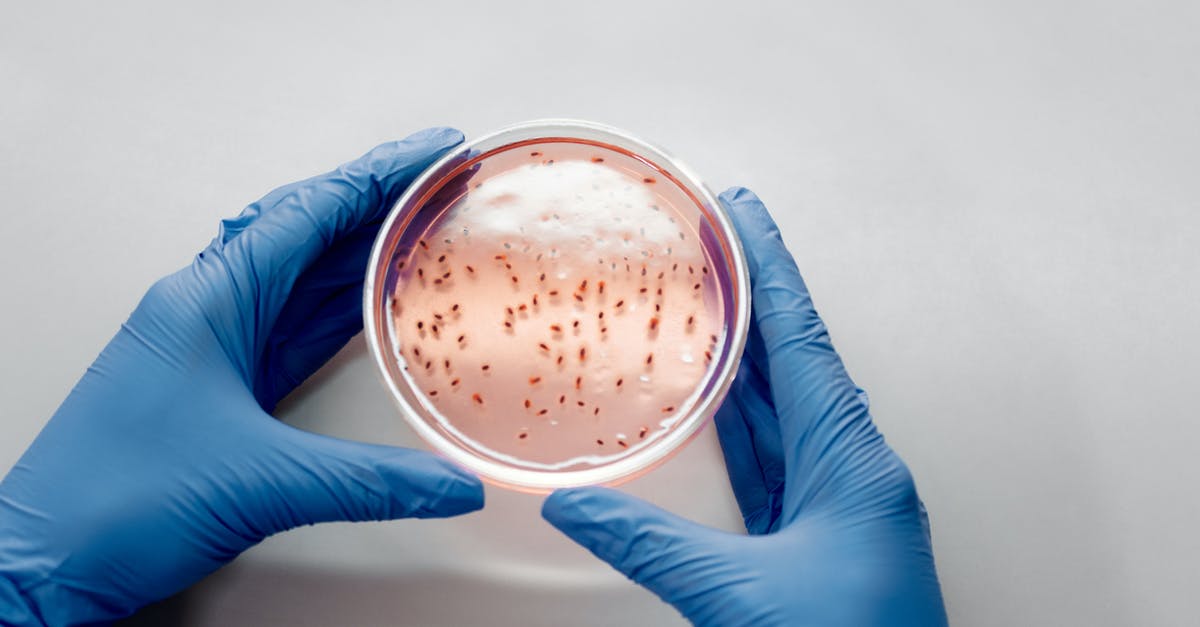 Are these bacteria colonies in my canned sardines? - Petri Dish with Live Bacteria Are these bacteria colonies in my canned sardines? - Petri Dish with Live Bacteria