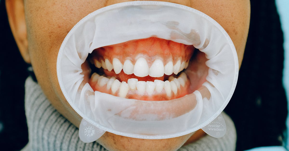 Do gums have any nutritional value? - Person With Dental Cheek Retractor Do gums have any nutritional value? - Person With Dental Cheek Retractor