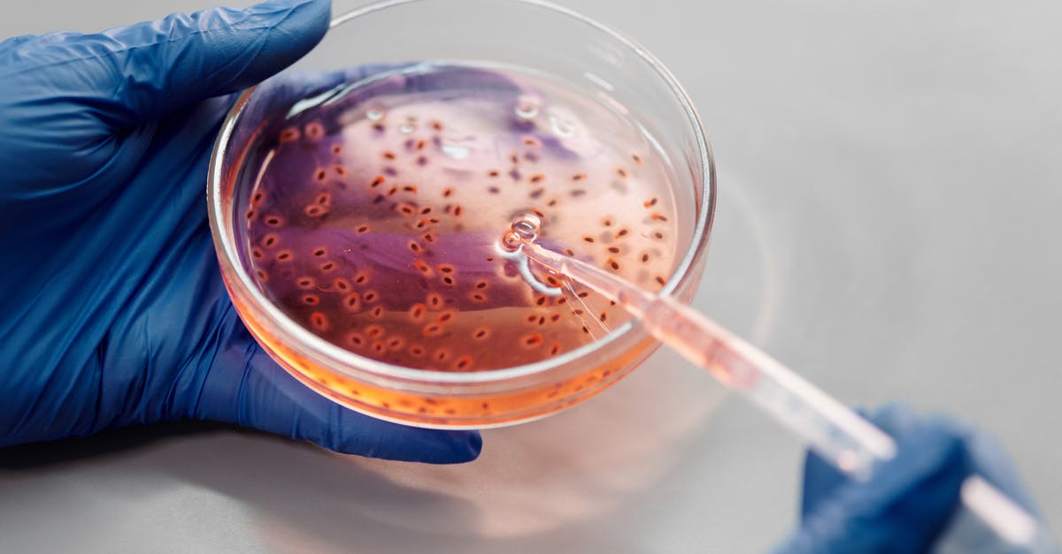 Does creme fraiche contain live bacteria in the same way that yoghurt does? - Person Using a Pipette Does creme fraiche contain live bacteria in the same way that yoghurt does? - Person Using a Pipette
