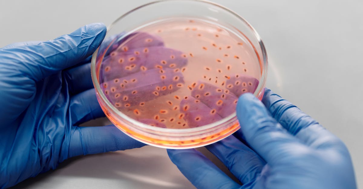 Does creme fraiche contain live bacteria in the same way that yoghurt does? - Live Bacteria in a Petri Dish Does creme fraiche contain live bacteria in the same way that yoghurt does? - Live Bacteria in a Petri Dish
