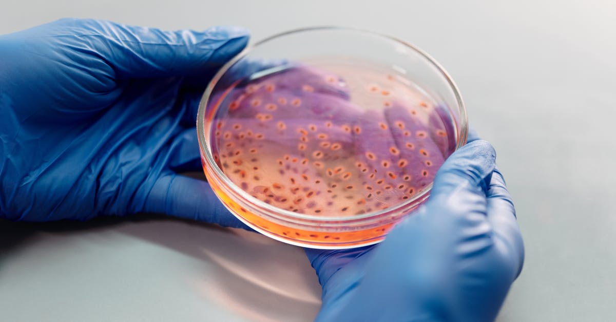 Does creme fraiche contain live bacteria in the same way that yoghurt does? - Person Holding a Petri Dish with Live Specimen Does creme fraiche contain live bacteria in the same way that yoghurt does? - Person Holding a Petri Dish with Live Specimen