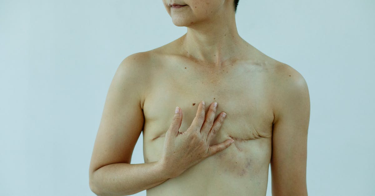 Duck breast; Trouble crisping skin - Crop anonymous female touching breast with scars after operation on white background of studio Duck breast; Trouble crisping skin - Crop anonymous female touching breast with scars after operation on white background of studio