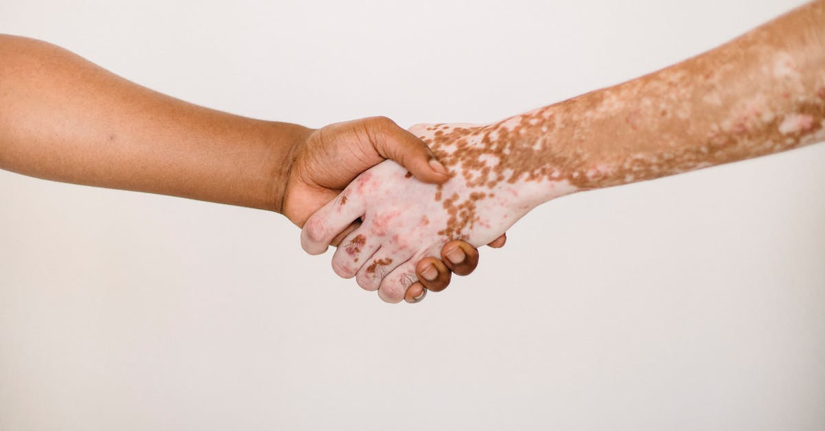 Help with rubbery roti/chapatti - Crop anonymous man shaking hand of male friend with vitiligo skin against white background Help with rubbery roti/chapatti - Crop anonymous man shaking hand of male friend with vitiligo skin against white background
