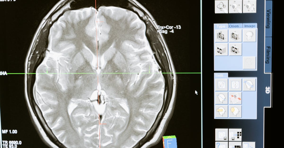 Recipe interpretation - Free stock photo of analysis, anatomy, brain
