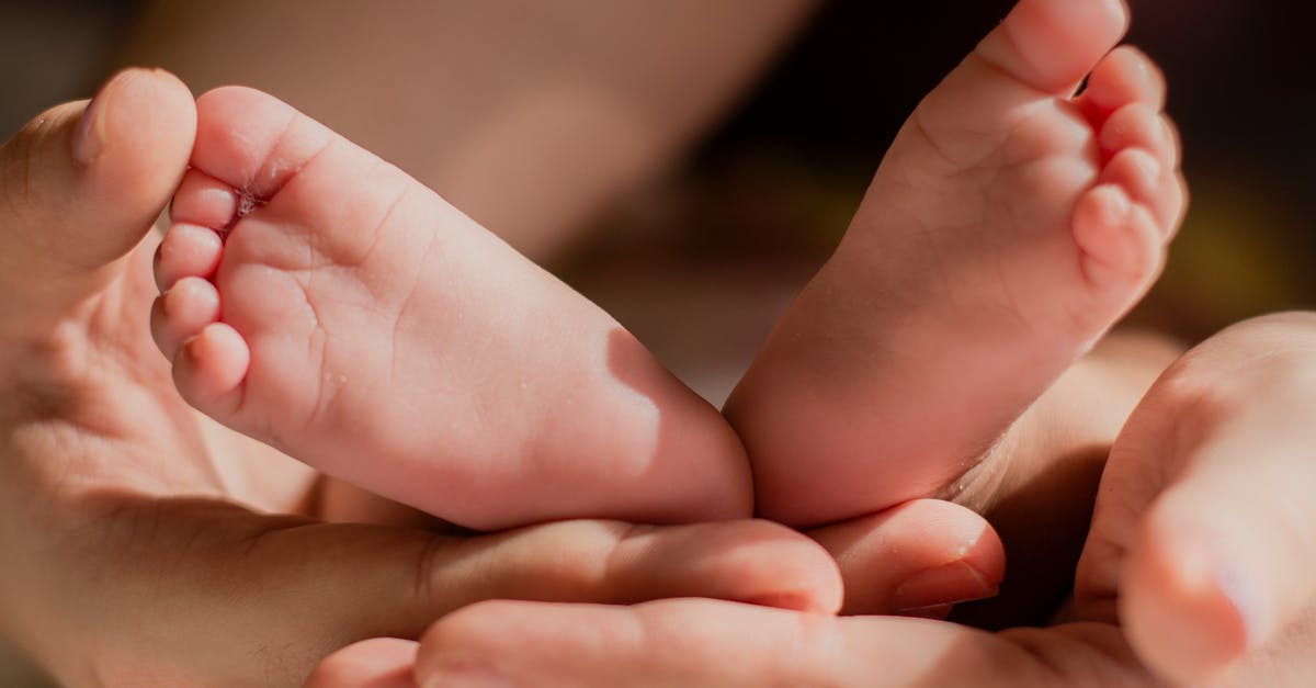 Should I skin the common sole for pan? - Person Holding Babys Feet Should I skin the common sole for pan? - Person Holding Babys Feet
